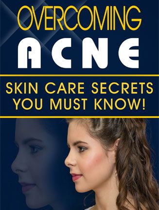 Overcoming Acne